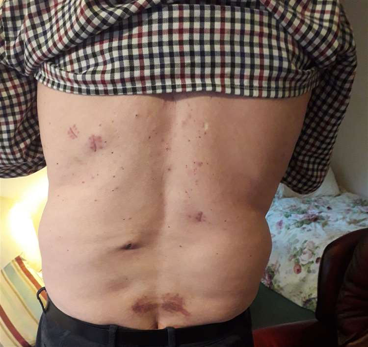 Stephen Hopper stabbed